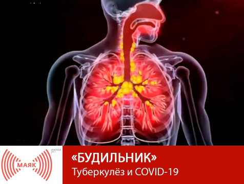 Будильник. Туберкулёз и COVID-19