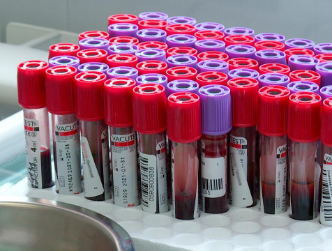 О донорстве костного мозга расскажут калужанам