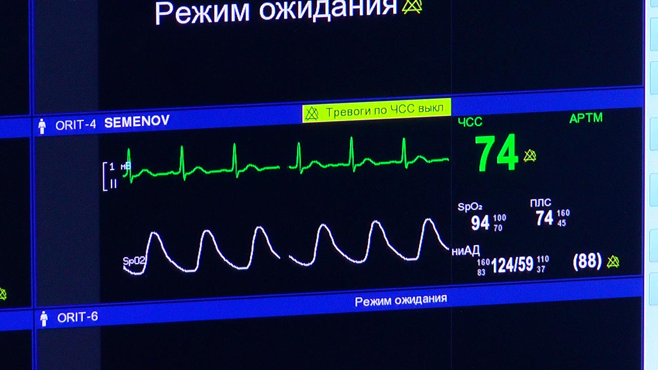 Отделение ранней реабилитации после инсульта открыли в калужской больнице 