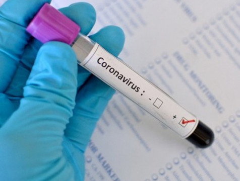 119 новых случаев коронавируса выявили в Калужской области