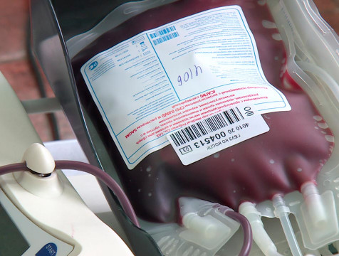 Новое отделение гемодиализа открылось в Калуге