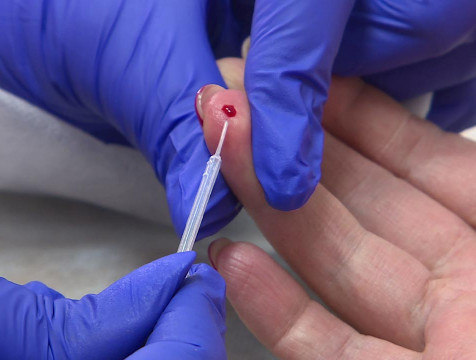 В Калуге можно пройти экспресс-тестирование на ВИЧ и вирусные гепатиты В и С