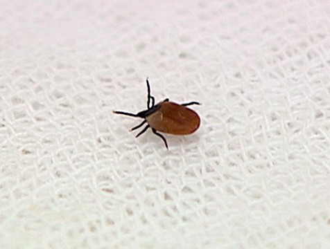 За неделю с калужан сняли 20 клещей, зараженных боррелиозом