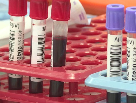 День донора пройдет 26 сентября в Калуге