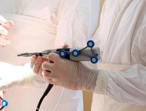 Калужские врачи проводят операции с помощью уникального робота-ортопеда