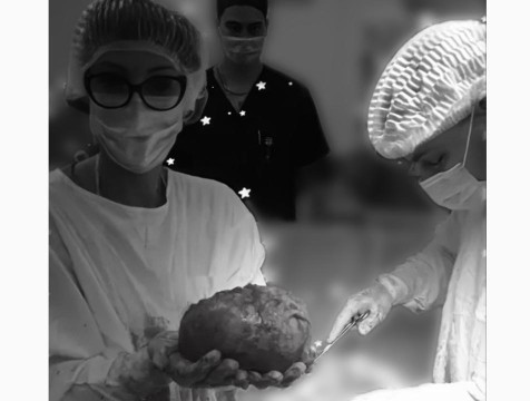 Женщине с крупными миомами провели успешное кесарево сечение в Калуге